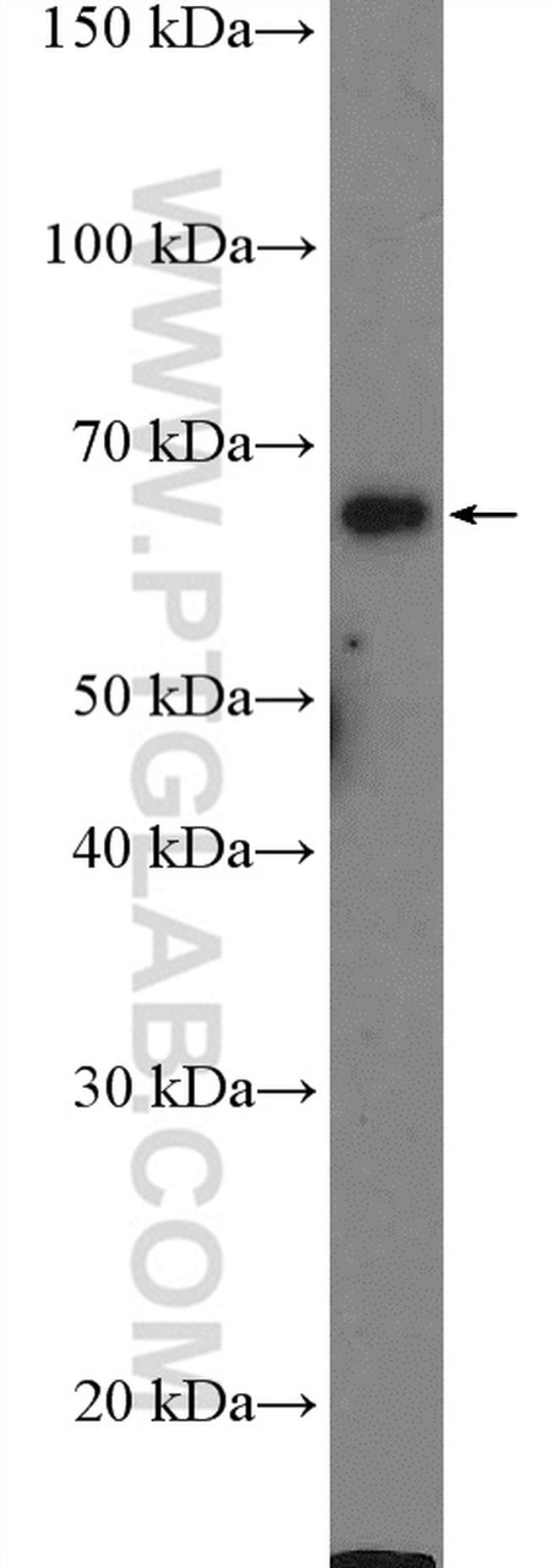 GAD1 Antibody in Western Blot (WB)