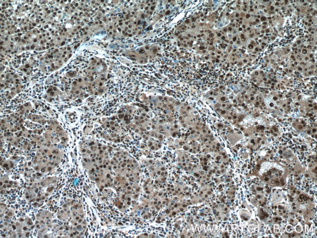 NFKB2 Antibody in Immunohistochemistry (Paraffin) (IHC (P))