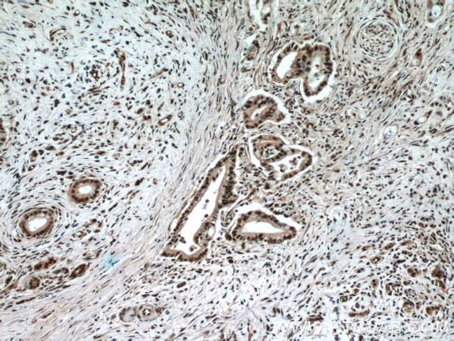 NFKB2 Antibody in Immunohistochemistry (Paraffin) (IHC (P))