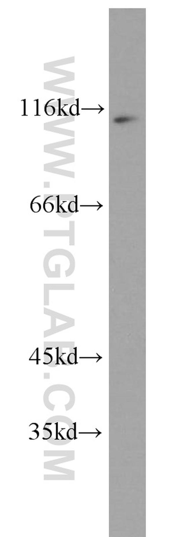 NFKB2 Antibody in Western Blot (WB)