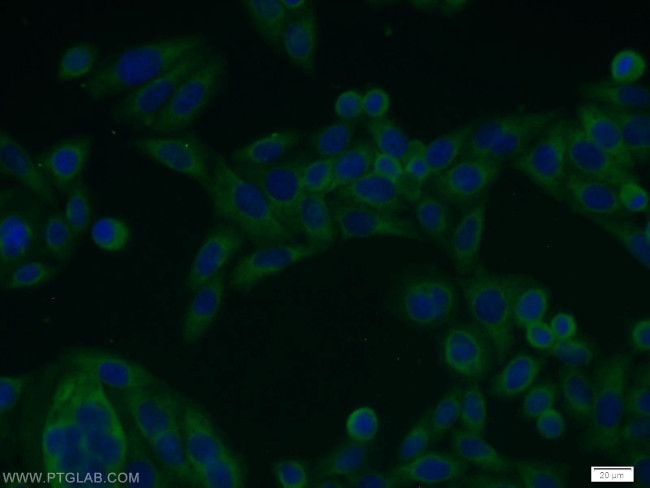 NFKB2 Antibody in Immunocytochemistry (ICC/IF)