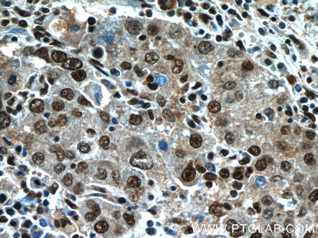 NFKB2 Antibody in Immunohistochemistry (Paraffin) (IHC (P))