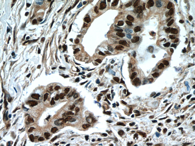 NFKB2 Antibody in Immunohistochemistry (Paraffin) (IHC (P))