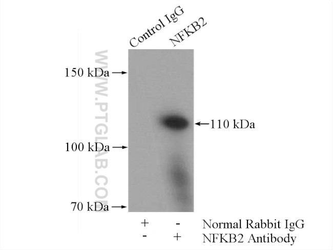 NFKB2 Antibody in Immunoprecipitation (IP)