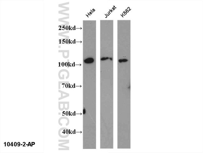 NFKB2 Antibody in Western Blot (WB)