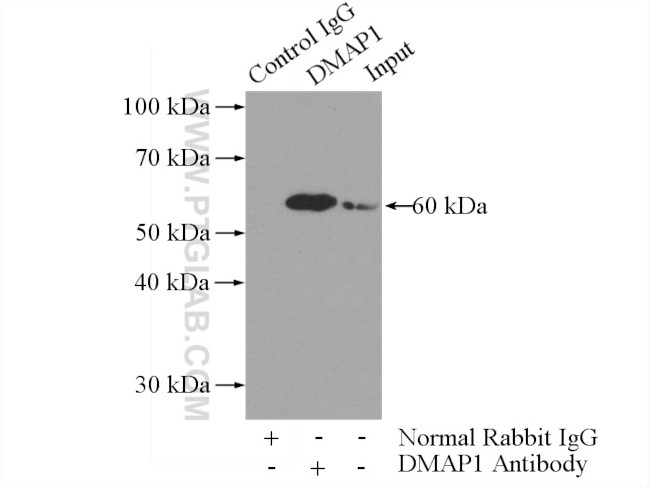 DMAP1 Antibody in Immunoprecipitation (IP)