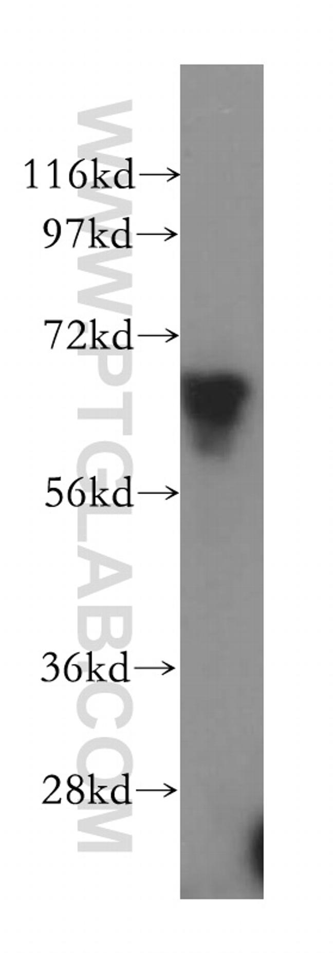 DMAP1 Antibody in Western Blot (WB)