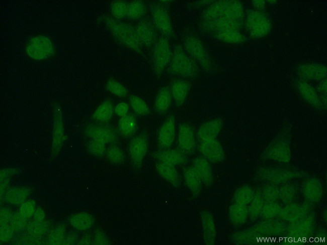 RPA2 Antibody in Immunocytochemistry (ICC/IF)