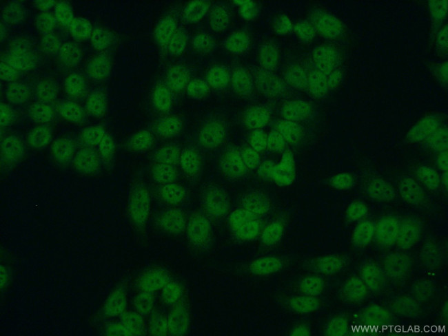 RPA2 Antibody in Immunocytochemistry (ICC/IF)