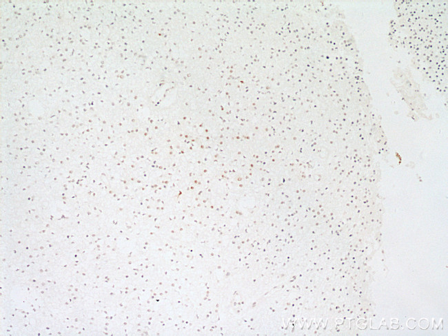 RPA2 Antibody in Immunohistochemistry (Paraffin) (IHC (P))