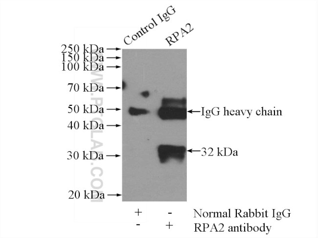 RPA2 Antibody in Immunoprecipitation (IP)