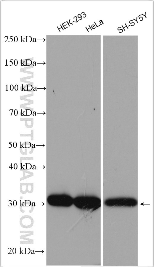 RPA2 Antibody in Western Blot (WB)