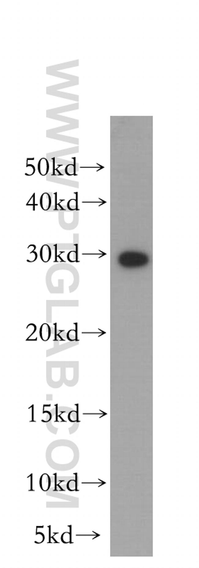 RPA2 Antibody in Western Blot (WB)