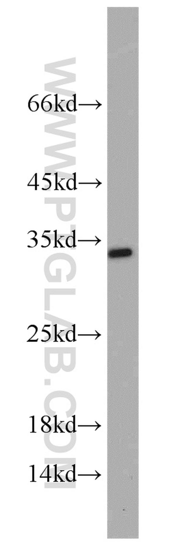 RPA2 Antibody in Western Blot (WB)