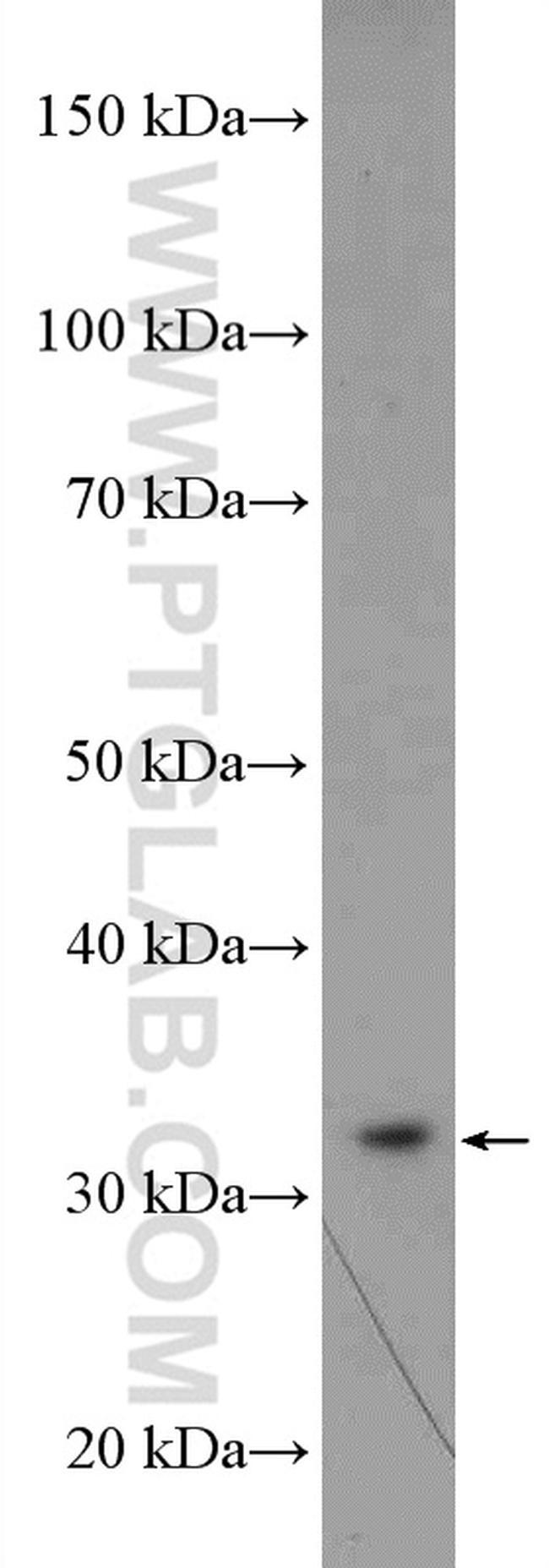 RPA2 Antibody in Western Blot (WB)