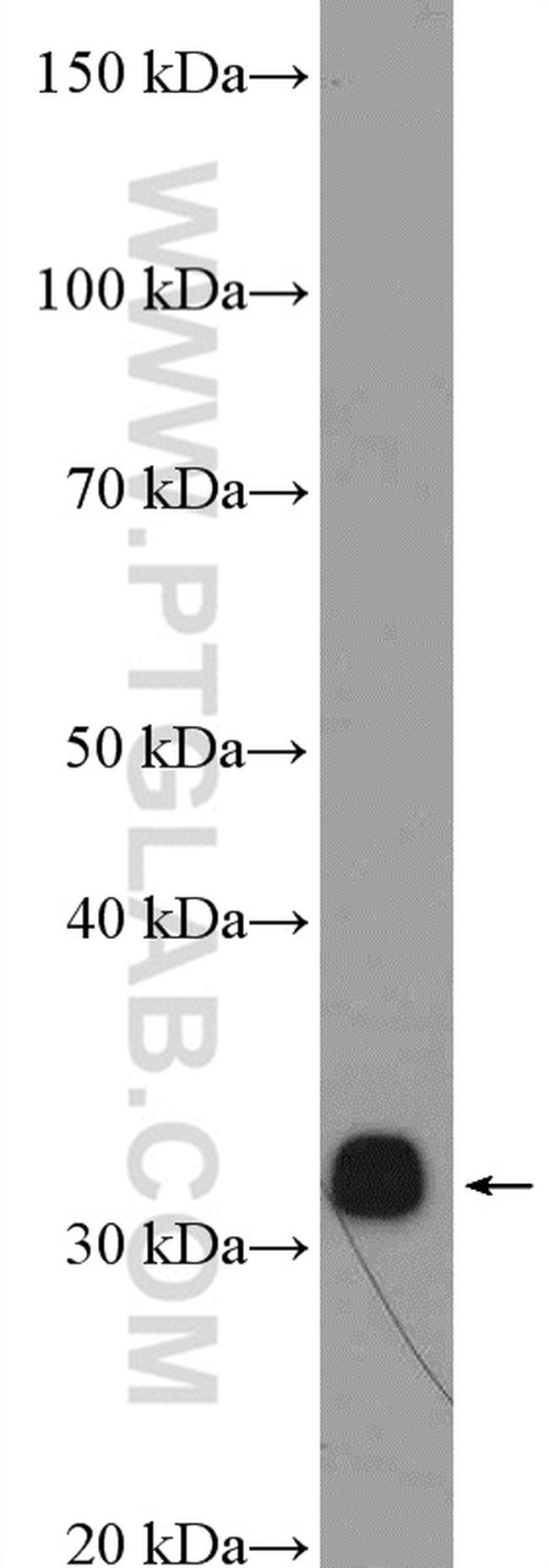 RPA2 Antibody in Western Blot (WB)