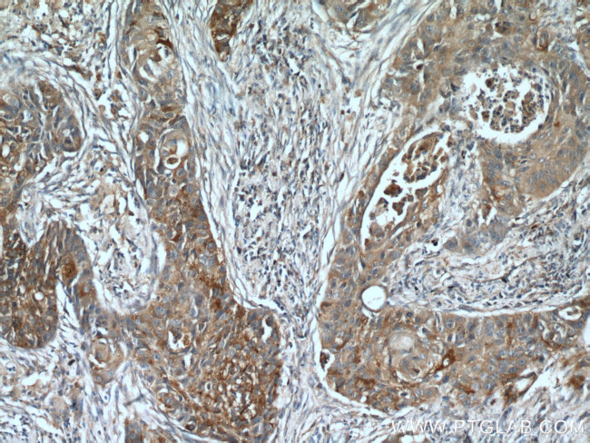 PLUNC Antibody in Immunohistochemistry (Paraffin) (IHC (P))