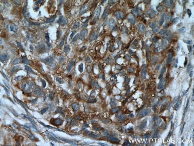 PLUNC Antibody in Immunohistochemistry (Paraffin) (IHC (P))