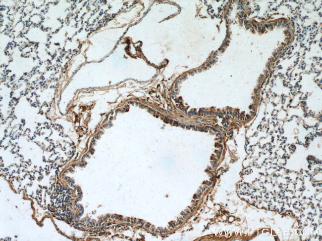 PLUNC Antibody in Immunohistochemistry (Paraffin) (IHC (P))