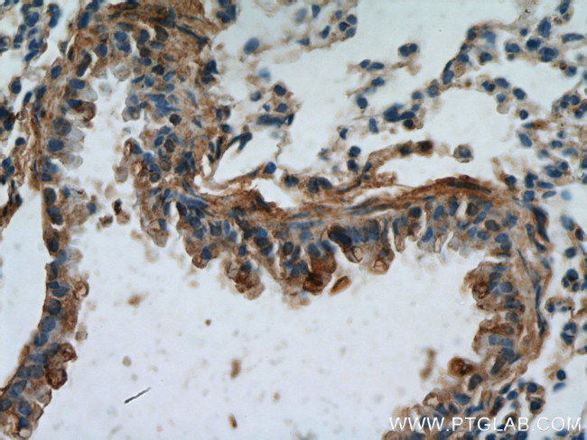 PLUNC Antibody in Immunohistochemistry (Paraffin) (IHC (P))