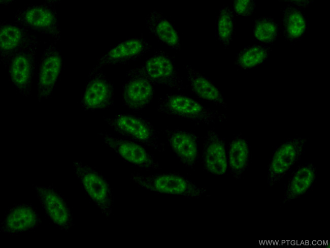 BCAS2 Antibody in Immunocytochemistry (ICC/IF)