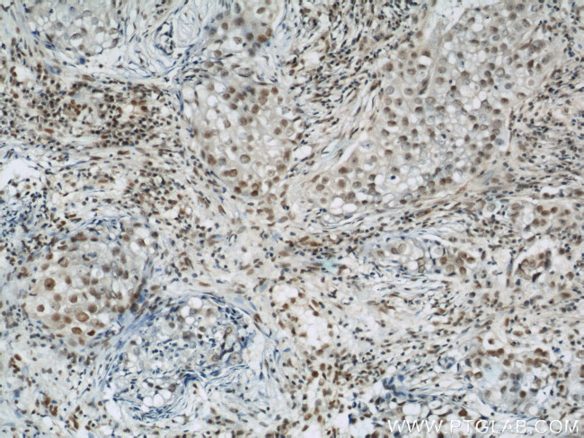 BCAS2 Antibody in Immunohistochemistry (Paraffin) (IHC (P))