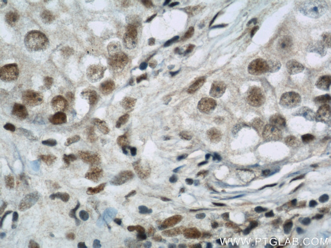 BCAS2 Antibody in Immunohistochemistry (Paraffin) (IHC (P))