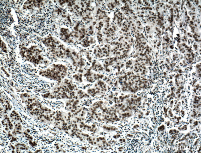 BCAS2 Antibody in Immunohistochemistry (Paraffin) (IHC (P))