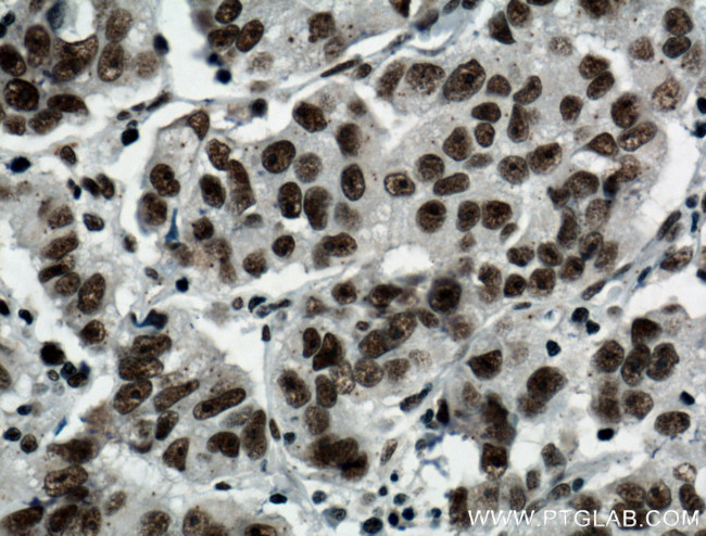 BCAS2 Antibody in Immunohistochemistry (Paraffin) (IHC (P))