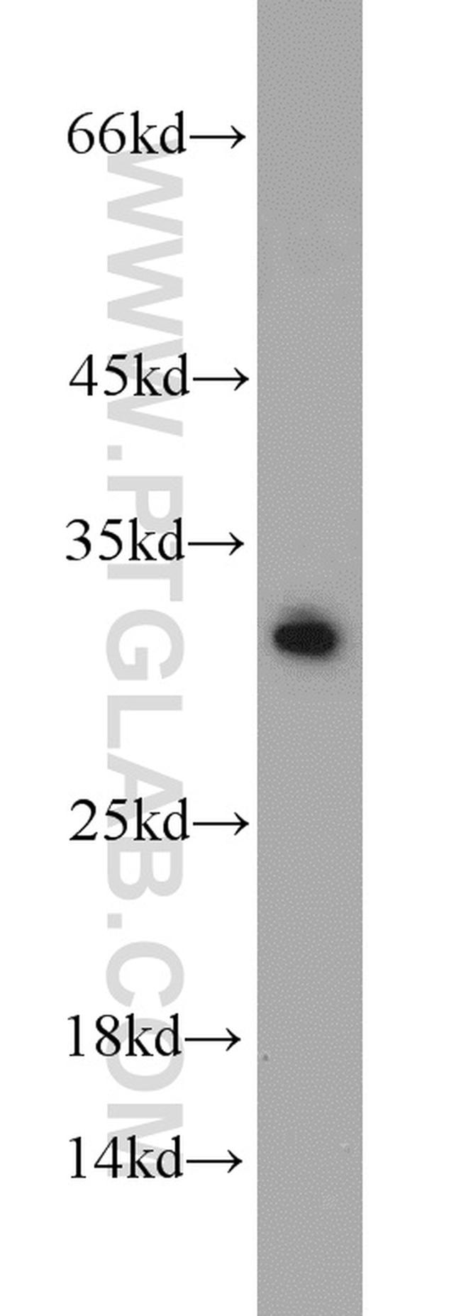 BCAS2 Antibody in Western Blot (WB)