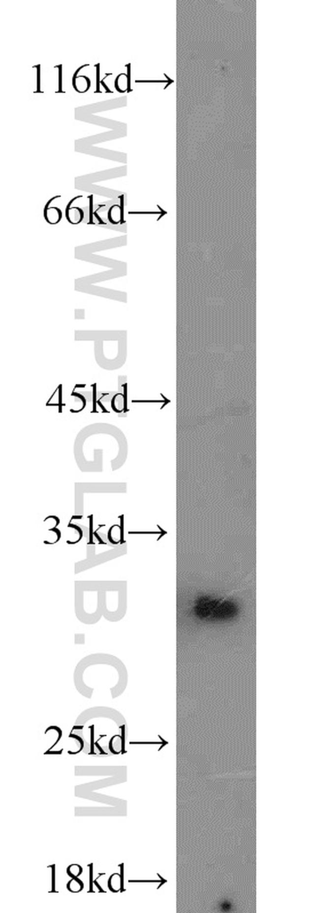 BCAS2 Antibody in Western Blot (WB)