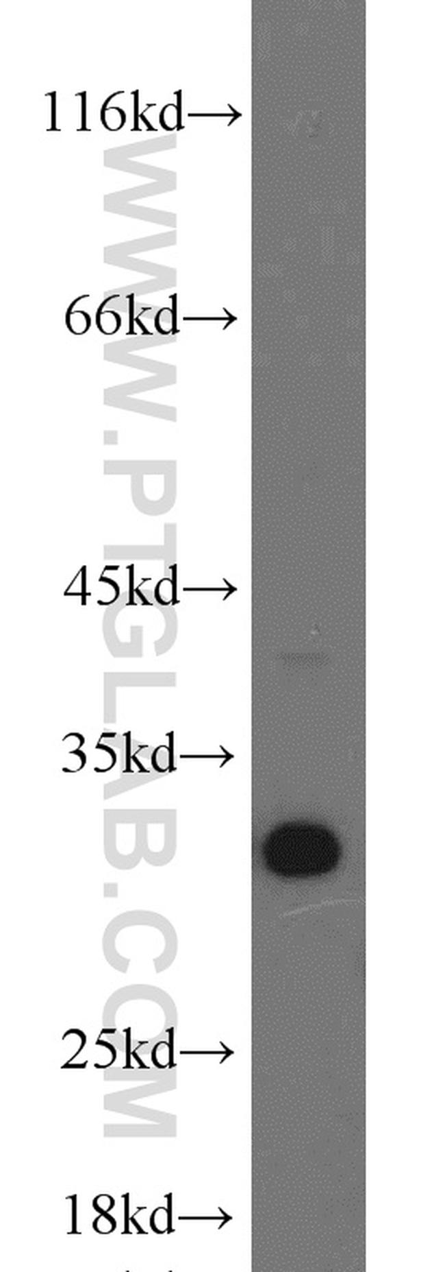 BCAS2 Antibody in Western Blot (WB)