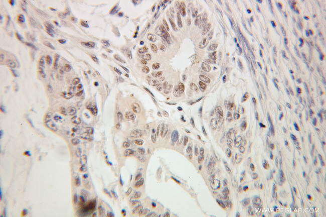 GATA3 Antibody in Immunohistochemistry (Paraffin) (IHC (P))