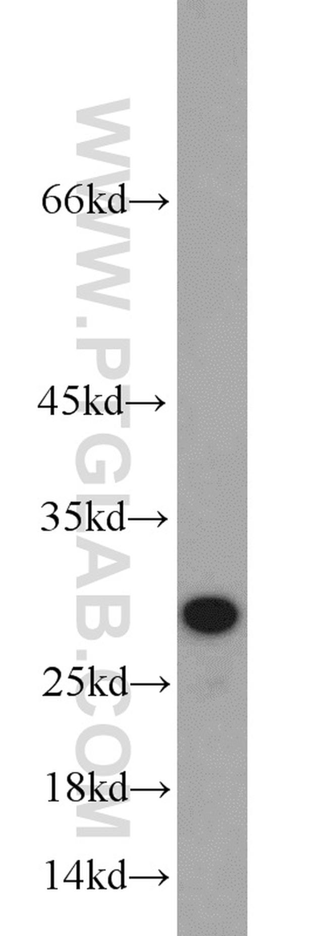 CD151 Antibody in Western Blot (WB)