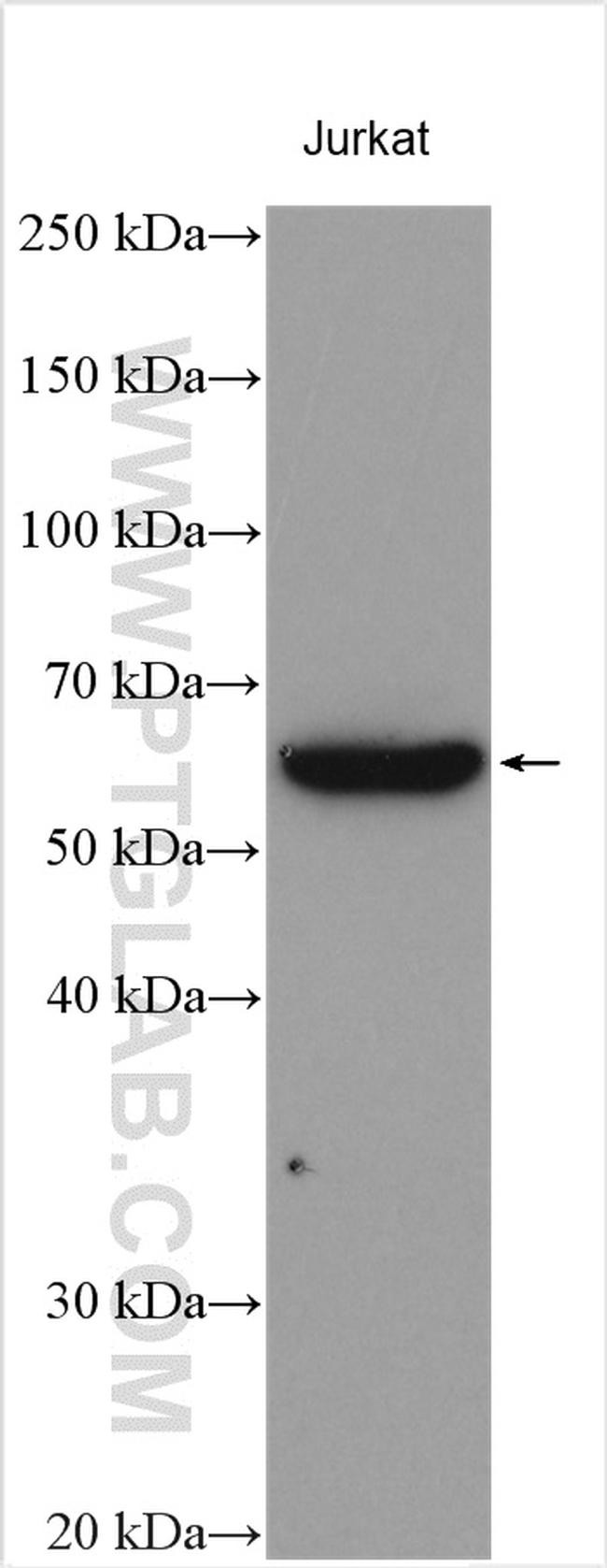Calpain 10 Antibody in Western Blot (WB)