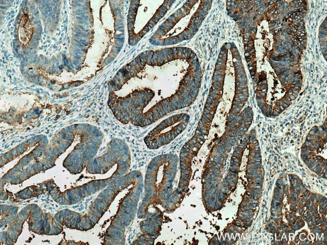 CEA Antibody in Immunohistochemistry (Paraffin) (IHC (P))