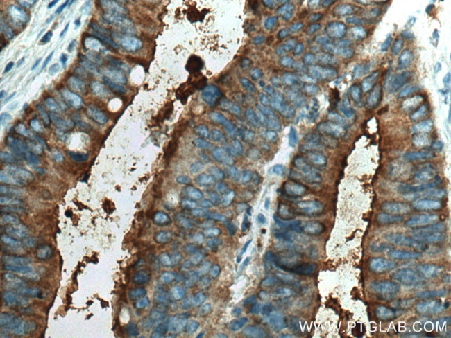 CEA Antibody in Immunohistochemistry (Paraffin) (IHC (P))