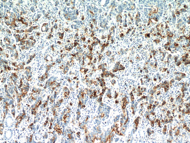 CEA Antibody in Immunohistochemistry (Paraffin) (IHC (P))