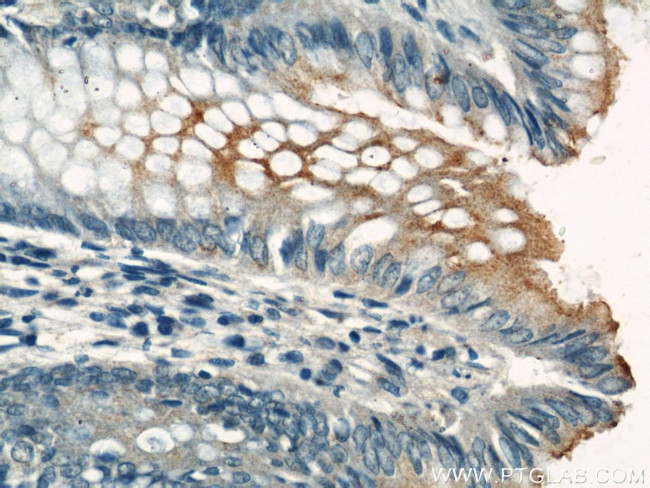 CEA Antibody in Immunohistochemistry (Paraffin) (IHC (P))