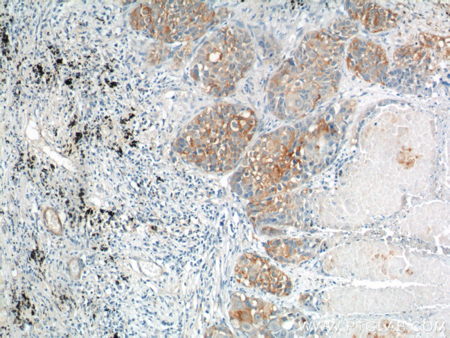 CEA Antibody in Immunohistochemistry (Paraffin) (IHC (P))