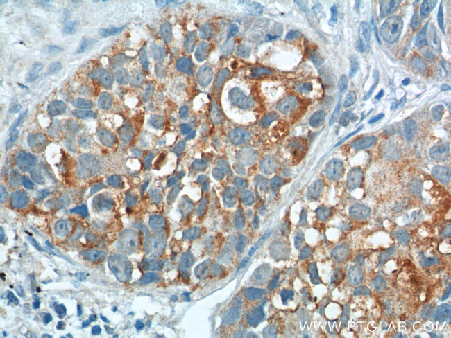 CEA Antibody in Immunohistochemistry (Paraffin) (IHC (P))