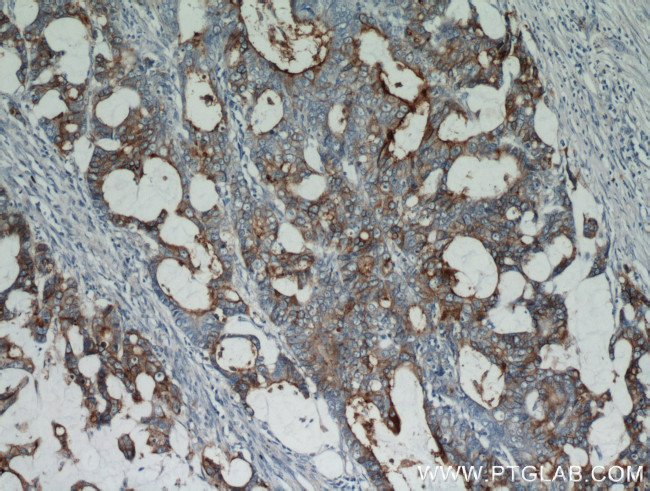 CEA Antibody in Immunohistochemistry (Paraffin) (IHC (P))