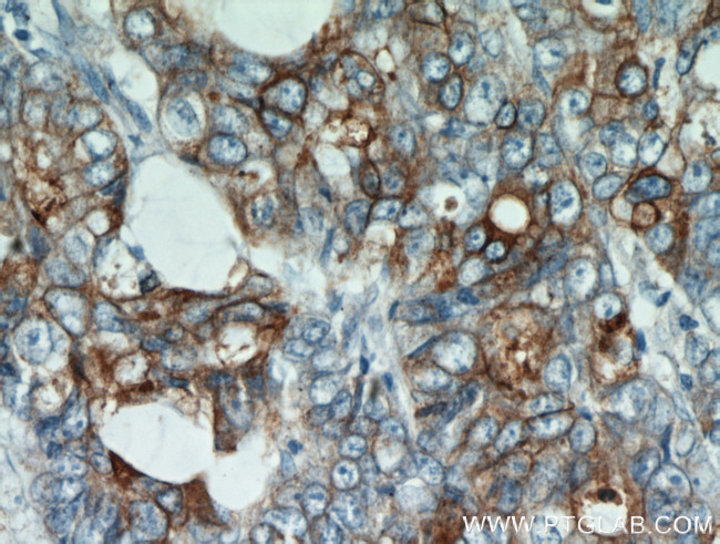 CEA Antibody in Immunohistochemistry (Paraffin) (IHC (P))