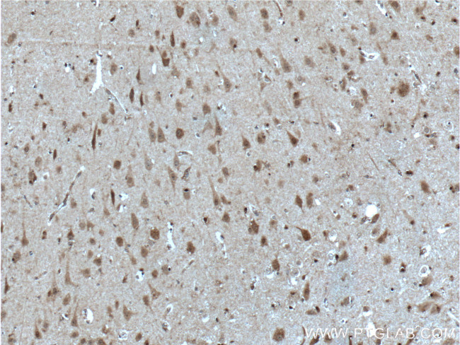 SOX10 Antibody in Immunohistochemistry (Paraffin) (IHC (P))