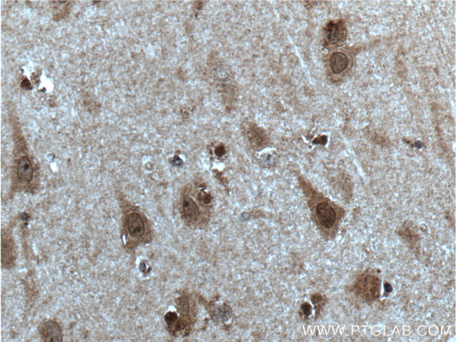 SOX10 Antibody in Immunohistochemistry (Paraffin) (IHC (P))