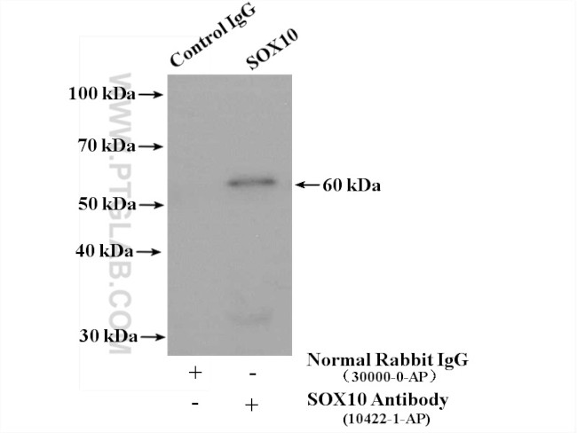 SOX10 Antibody in Immunoprecipitation (IP)