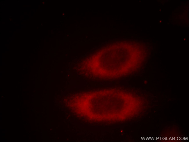 JTV1 Antibody in Immunocytochemistry (ICC/IF)