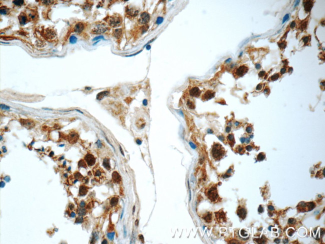 JTV1 Antibody in Immunohistochemistry (Paraffin) (IHC (P))