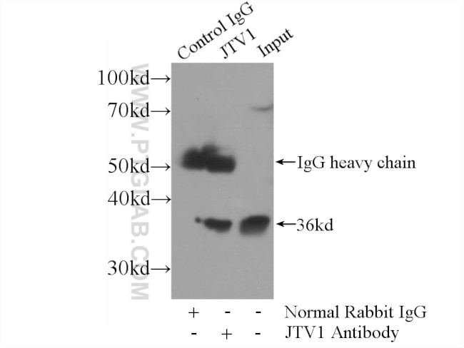 JTV1 Antibody in Immunoprecipitation (IP)