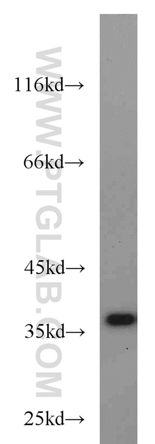 JTV1 Antibody in Western Blot (WB)